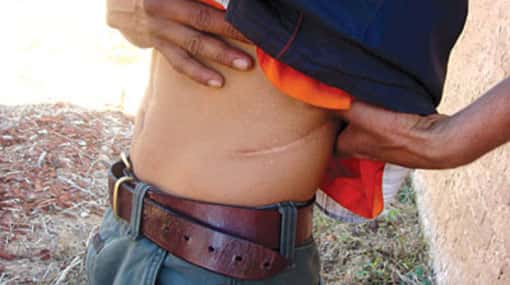 Kidney racket: Sri Lankan health officials involved - report claims