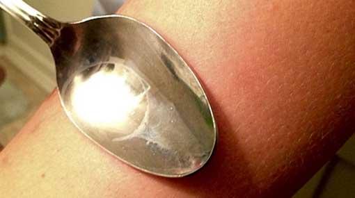 Mother burns 4-year-old using metal spoon
