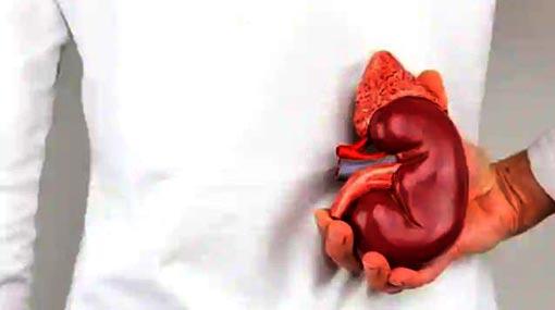 Indian woman arrested over kidney selling racket in Sri Lanka