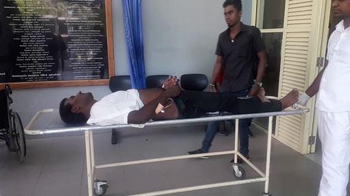 SLTB bus driver critically injured in assault