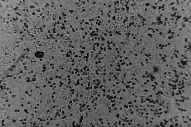Coronavirus: Australian scientists first to recreate virus outside China