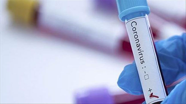Sri Lanka’s COVID-19 cases climb to 104