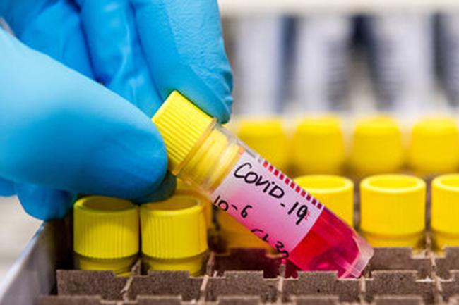 Two more COVID-19 patients recover; Positive cases tally drops to 97