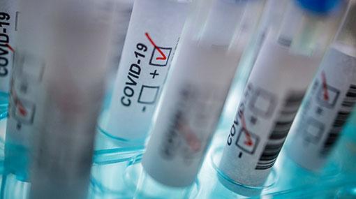 120 confirmed cases of COVID-19 in Sri Lanka