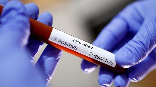 Two new COVID-19 cases brings total to 122