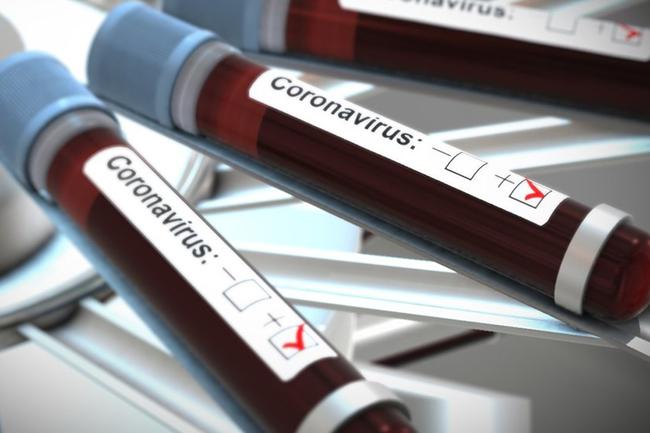 COVID-19 cases tally jumps to 142 as 10 more test positive
