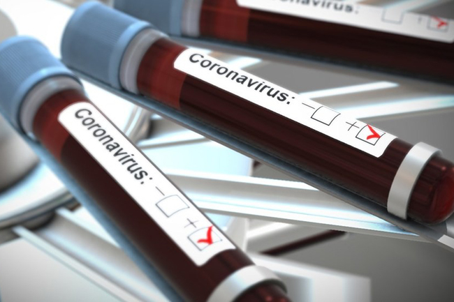 COVID-19 cases tally jumps to 142 as 10 more test positive