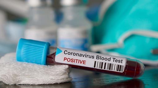 Another COVID-19 case raises total to 167