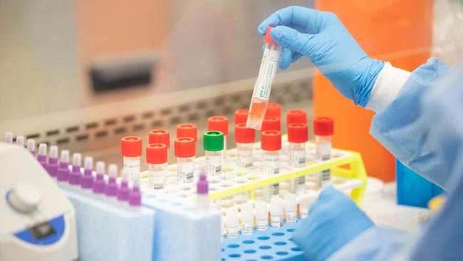 Coronavirus cases tally reaches 170