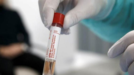 Covid-19 cases climbs to 176 in Sri Lanka