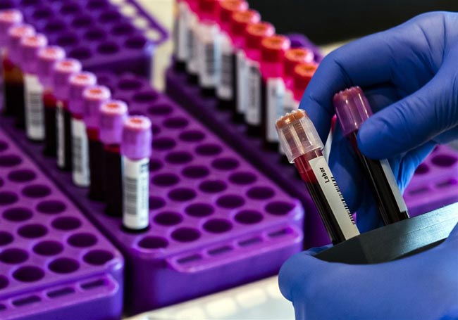 Two new COVID-19 cases reported bringing total to 178
