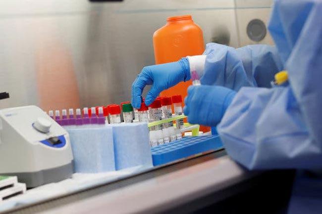 More confirmed COVID-19 cases hike count to 185