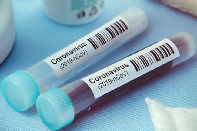 Sri Lanka’s coronavirus cases count at 186