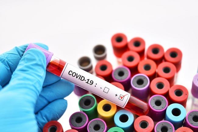 COVID-19 case tally hikes to 188 with 2 new cases