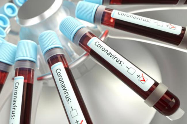 COVID-19: Infections tally hits 190, recoveries climb to 49