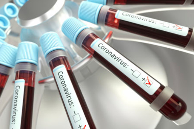 COVID-19: Infections tally hits 190, recoveries climb to 49