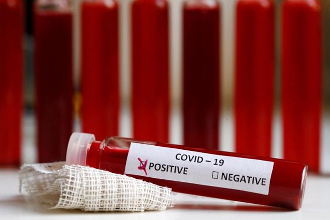 COVID-19: Sri Lanka’s cases count jumps to 197 with 7 new infections