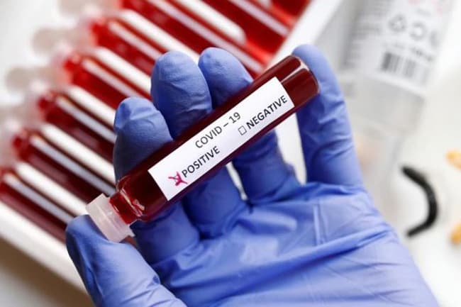 COVID-19 cases total in Sri Lanka at 238