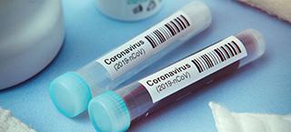 Nine COVID-19 patients recover; Total climbs to 86