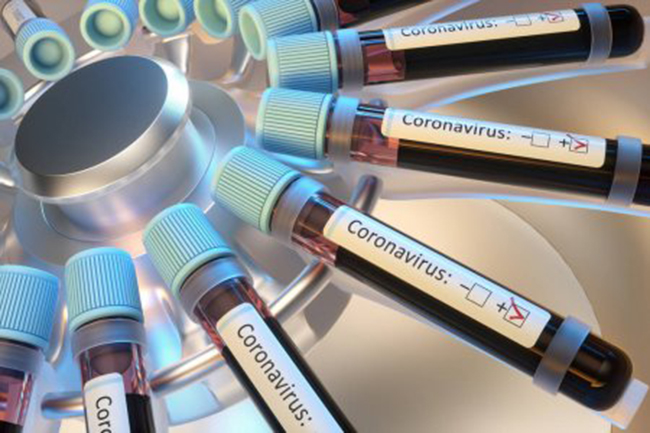 Eleven new COVID-19 cases bring total count to 321