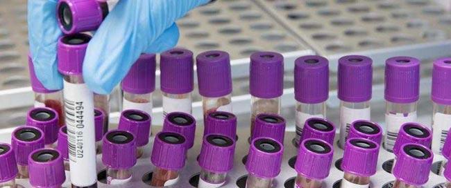 Total count at 471 with 4 new COVID-19 cases