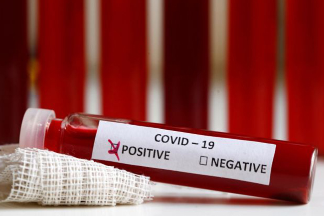 Coronavirus cases count hits 485 with 8 new infections