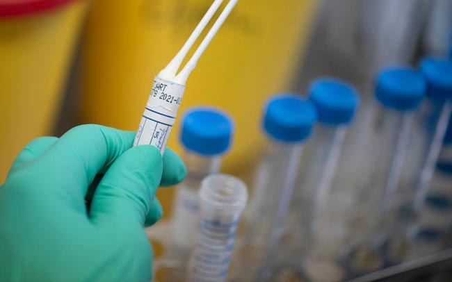 Recovered coronavirus patient tests positive again