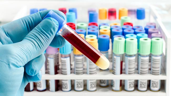 Coronavirus: Nineteen new cases detected, total at 751