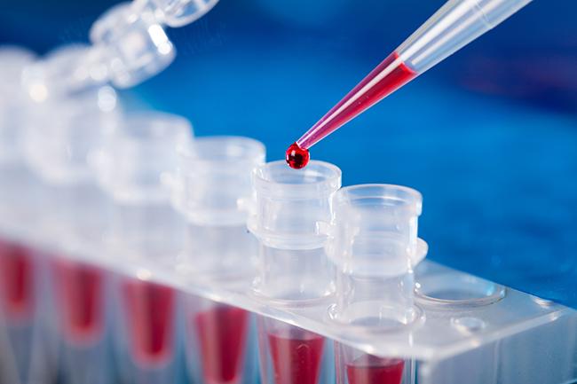 Nine coronavirus cases confirmed today are from Navy – Health Ministry