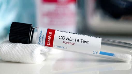 COVID-19: five new cases brings total to 986