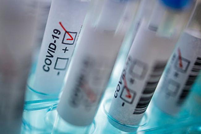 Coronavirus: Four new positive cases confirmed, total at 1,027