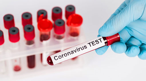 Two more Covid-19 cases take tally to 1,059