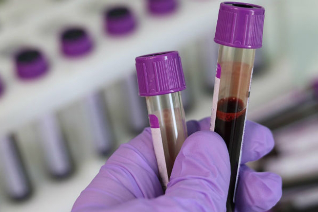 Sri Lanka’s coronavirus cases reach 1,140 with two new patients
