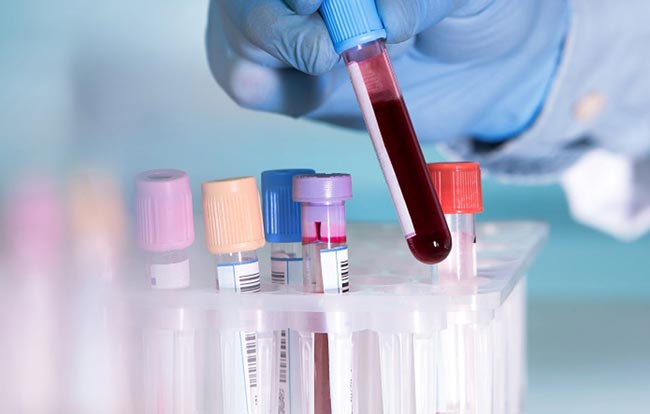 Fourteen more COVID-19 cases move total to 1,162