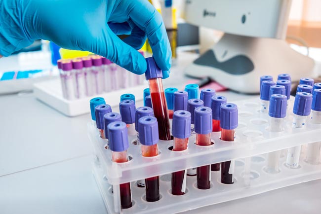 More cases jump coronavirus case tally to 1,199