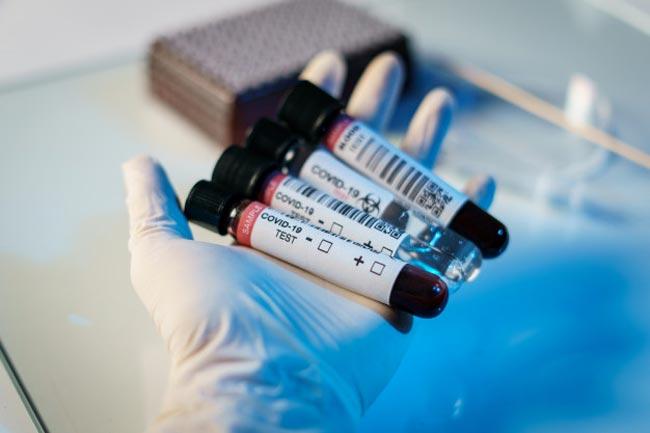 Coronavirus recoveries in Sri Lanka climb to 745