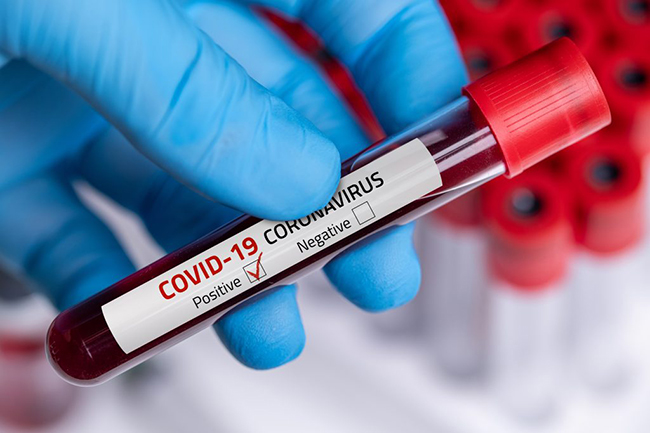 New COVID-19 patient brings cases count to 1,531