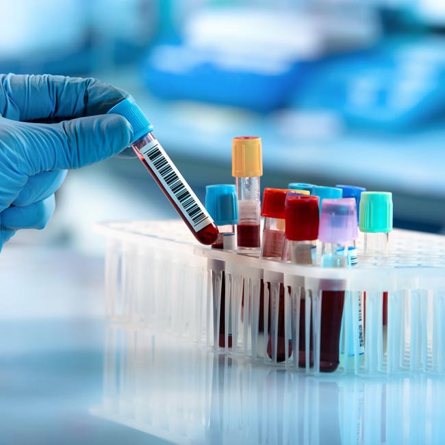 COVID-19: Eight new cases hike total to 1,628