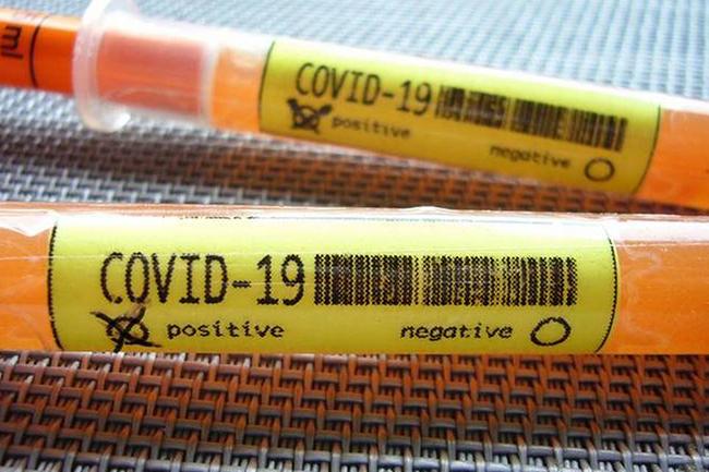 Covid-19: Two more cases confirmed from Navy, tally reaches 1,633