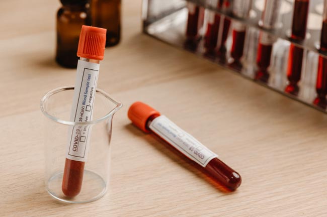Two fresh cases push coronavirus case count to 1,645