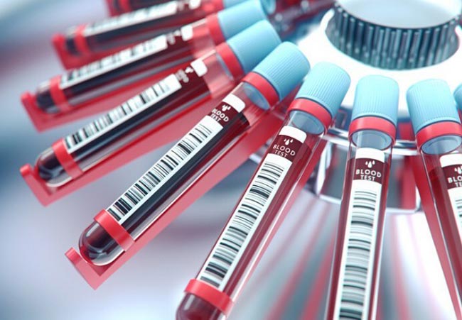 Dubai returnee takes coronavirus count to 1,648