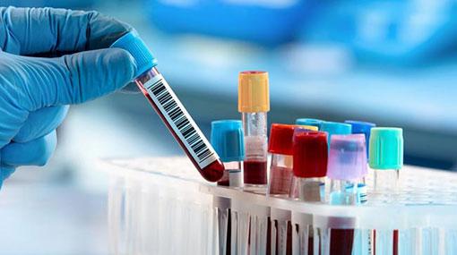 Four new Covid-19 cases brings total to 1,653