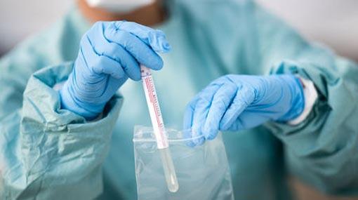 Eighteen new cases jump COVID-19 count to 1,710