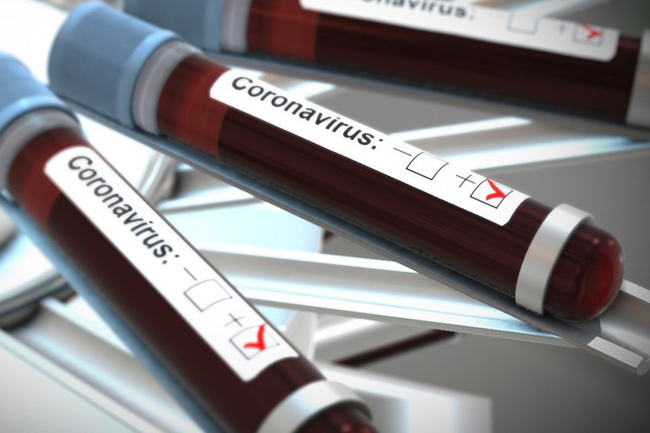 Three new COVID-19 patients add up 1,800 total cases
