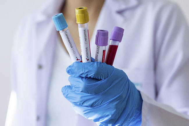 Sri Lanka’s COVID-19 infections hike to 1,810