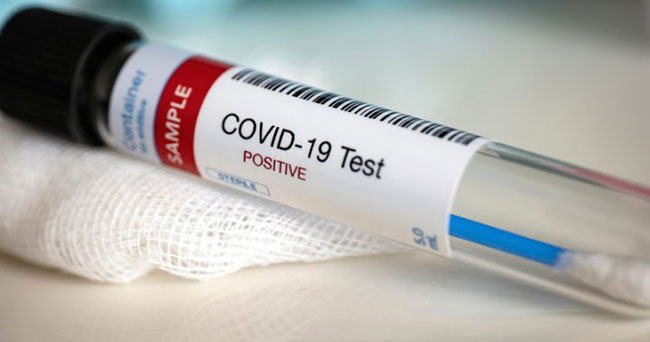 Covid-19 cases total moves to 2,054