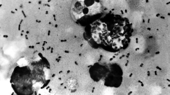 Case of bubonic plague reported in China’s Inner Mongolia