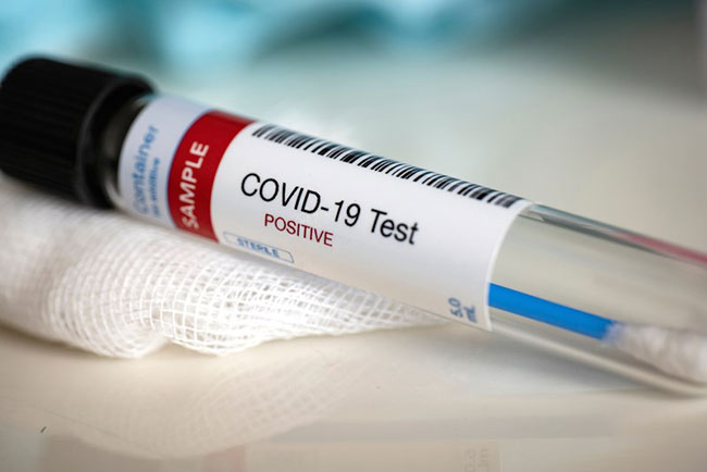 Two more Covid-19 cases bring total to 2,153