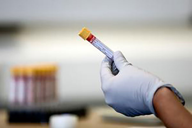Sri Lanka’s Covid-19 cases total climbs to 2,447