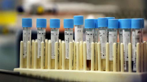 300 new cases of Covid-19 reported yesterday